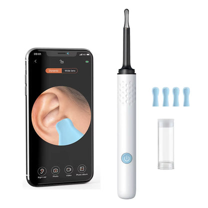 ClearView WiFi Ear Camera – HD Visual Ear Cleaner with LED Lights & Mini Earpick